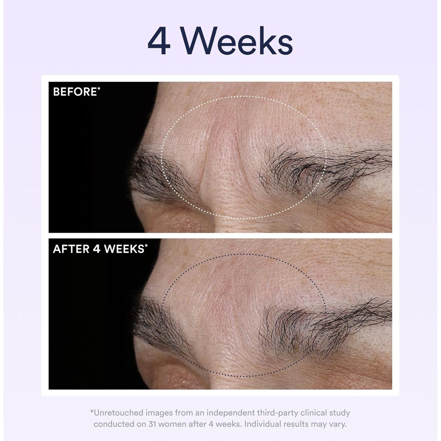 Anti Aging Night Serum with Retinol for Wrinkle Repair