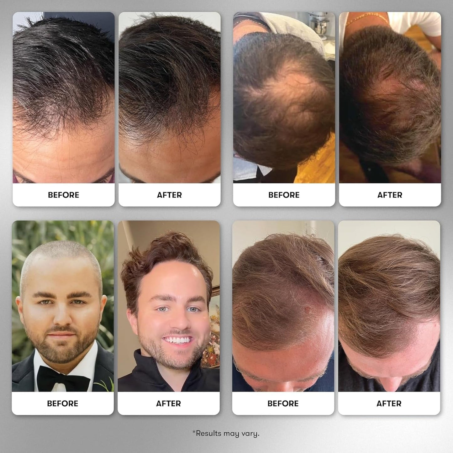 Natural Hair Growth Vitamins for Men - 90 Capsules