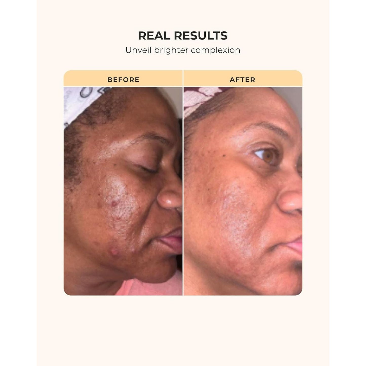 Natural Glow Skin Care Kit for Dark Skin Tones