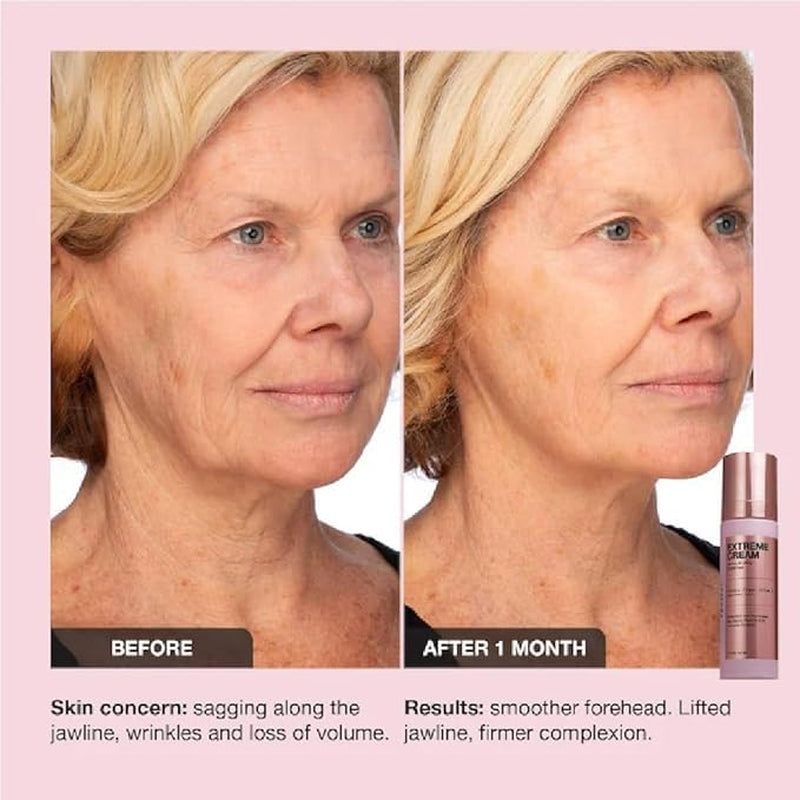 Intensive Anti Aging Face Cream Moisturizer
