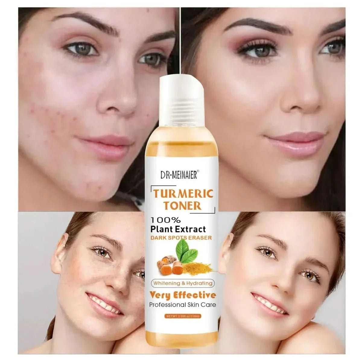 Natural Turmeric Face Toner for Acne & Glowing Skin