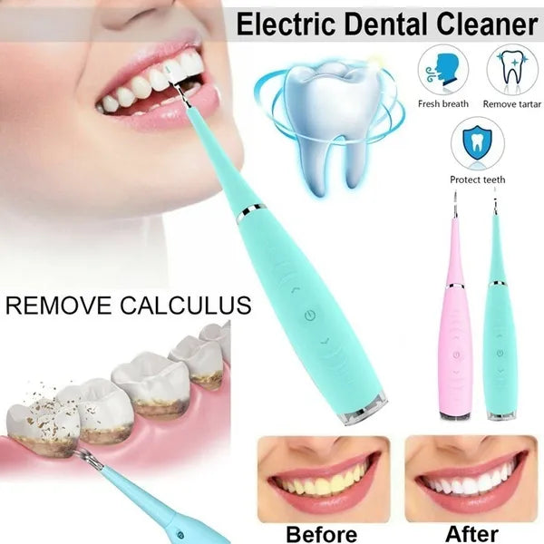 OralCare Ultrasonic Teeth Cleaner