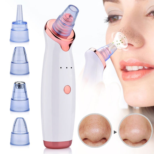 Electric Blackhead Remover Extractor Tool