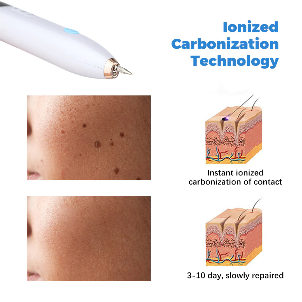 9 Level Plasma Pen Mole Wart Freckle Remover