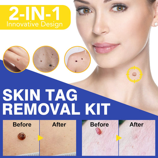 Skin Tag Removal Kit - Skin Tag Remover Patch