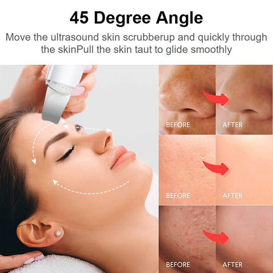 Ultrasonic Scraper Facial Skin Scrubber Remove Blackheads
