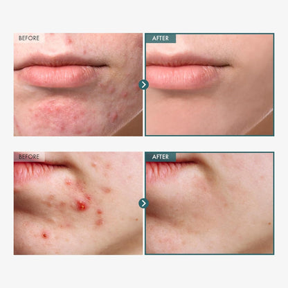 Soothing Cica Face Cream 100ml - Calming Redness Relief Moisturizer