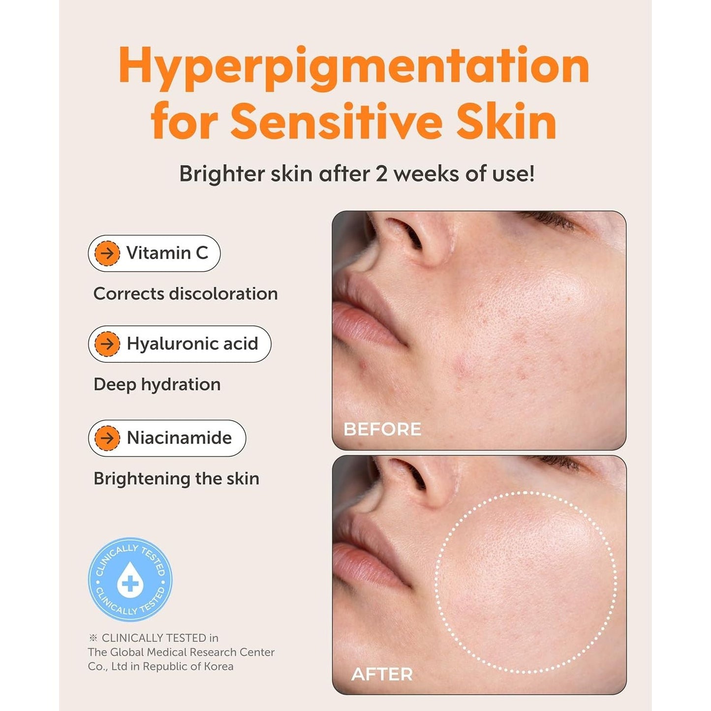 Natural Vitamin C Face Serum - Fades Spots, Smoothes Skin