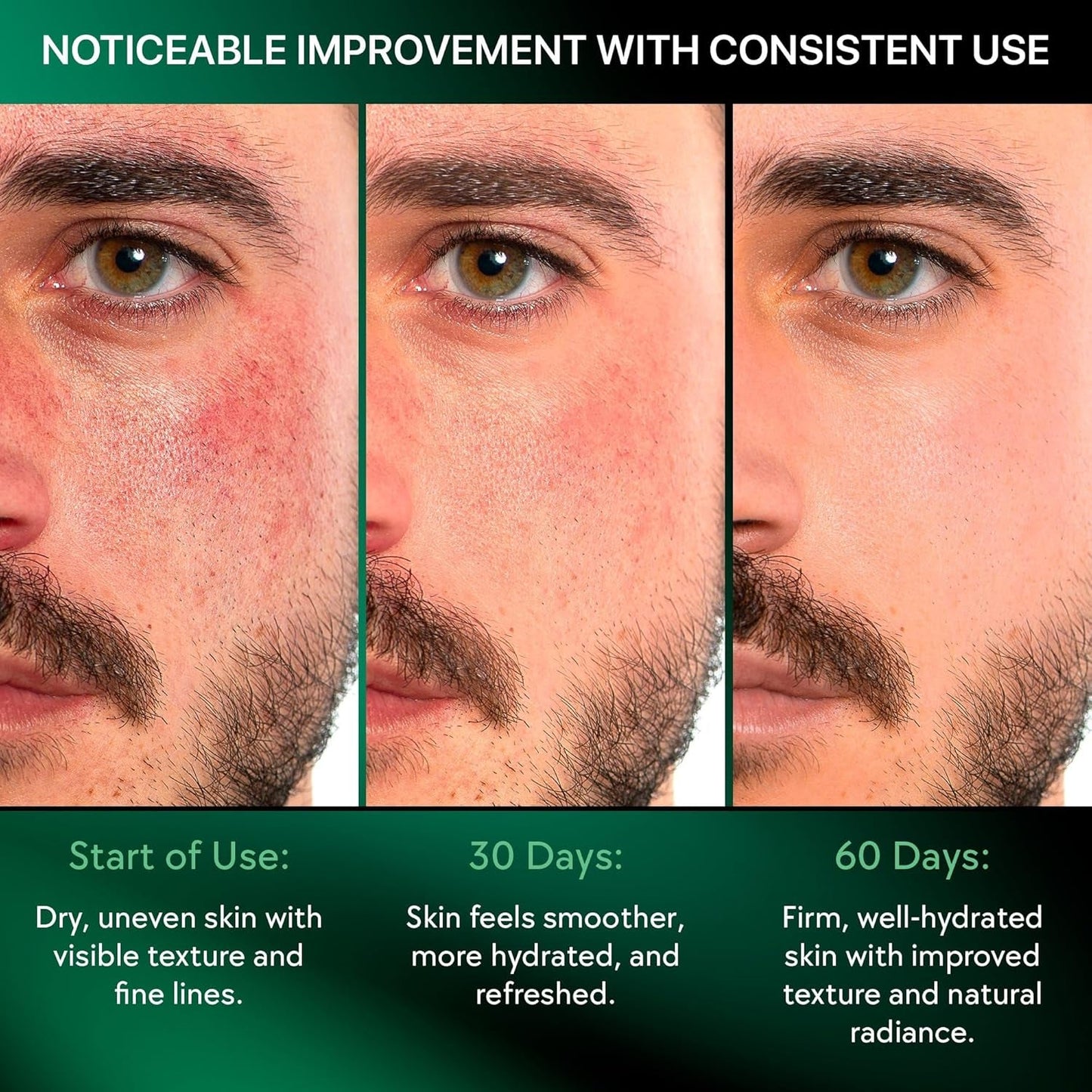 Wingo Mens Face Moisturizer Anti-Aging Cream 55ml - Oil-Free Quick Absorbing Moisture