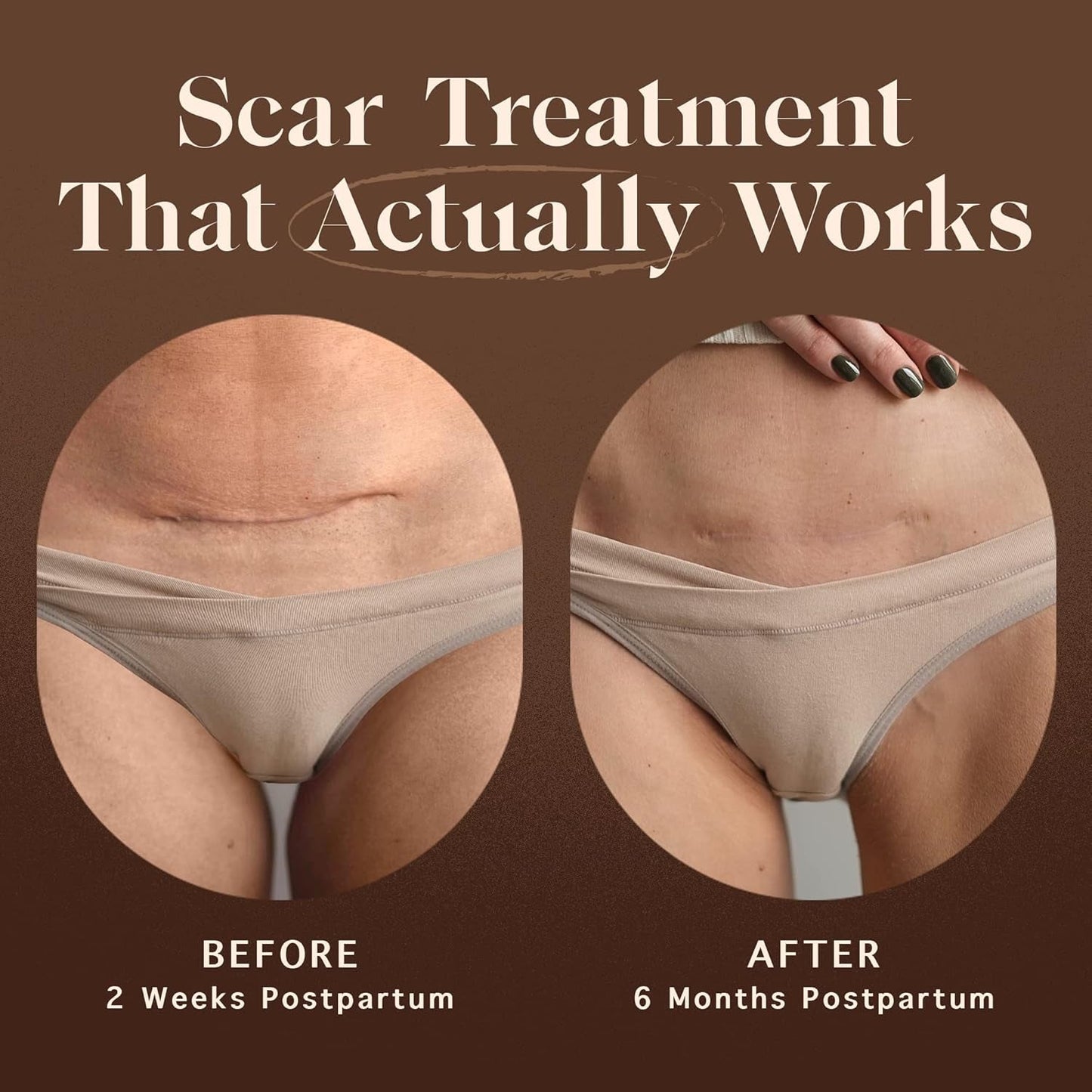 Natural Scar Repair Cream 30g