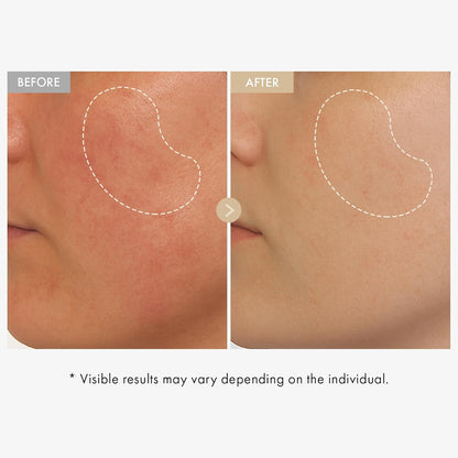 Natural Rice Serum 33ml - Evens Skin Tone, Fades Spots
