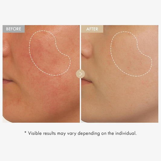 Natural Rice Serum 33ml - Evens Skin Tone, Fades Spots