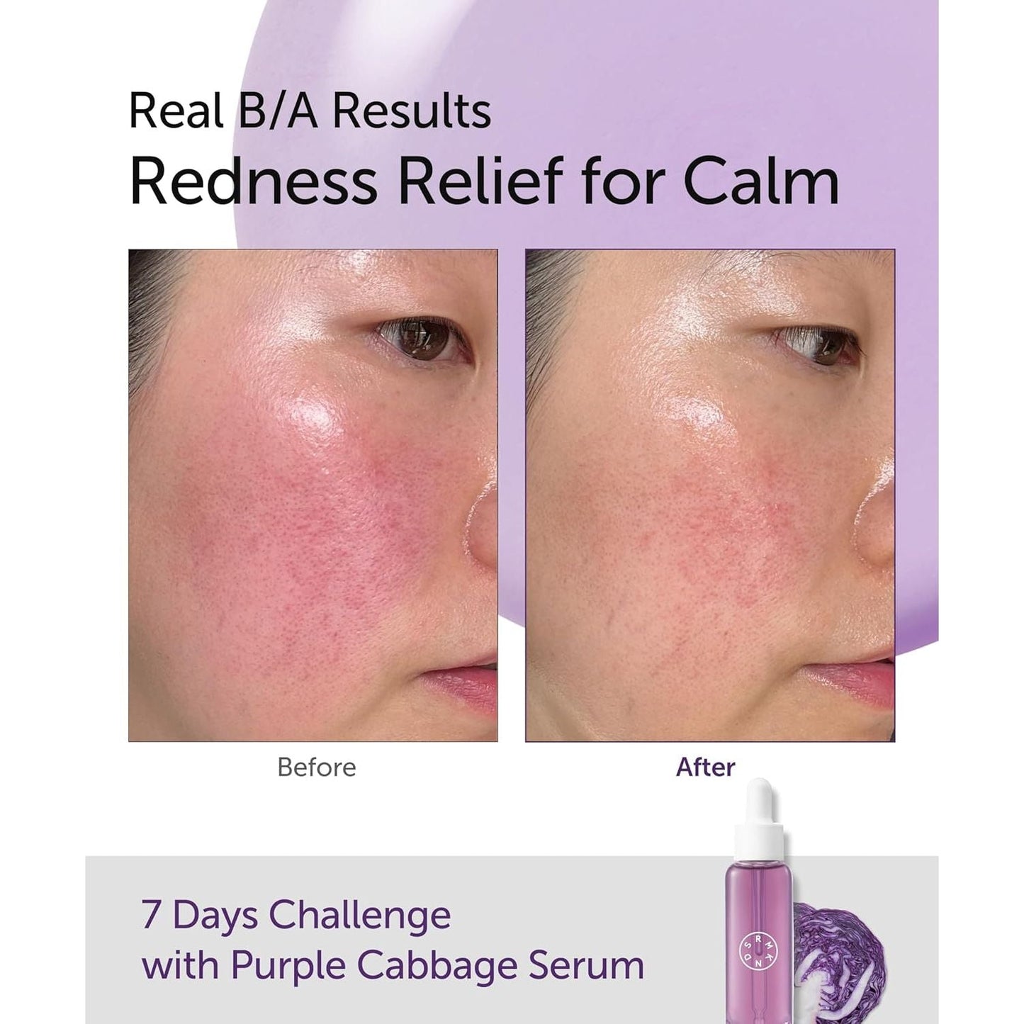 Soothing Purple Cabbage Face Serum