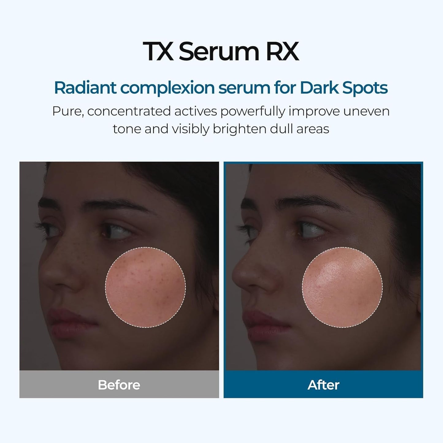 Intensive Brightening Skin Care Serum 30ml