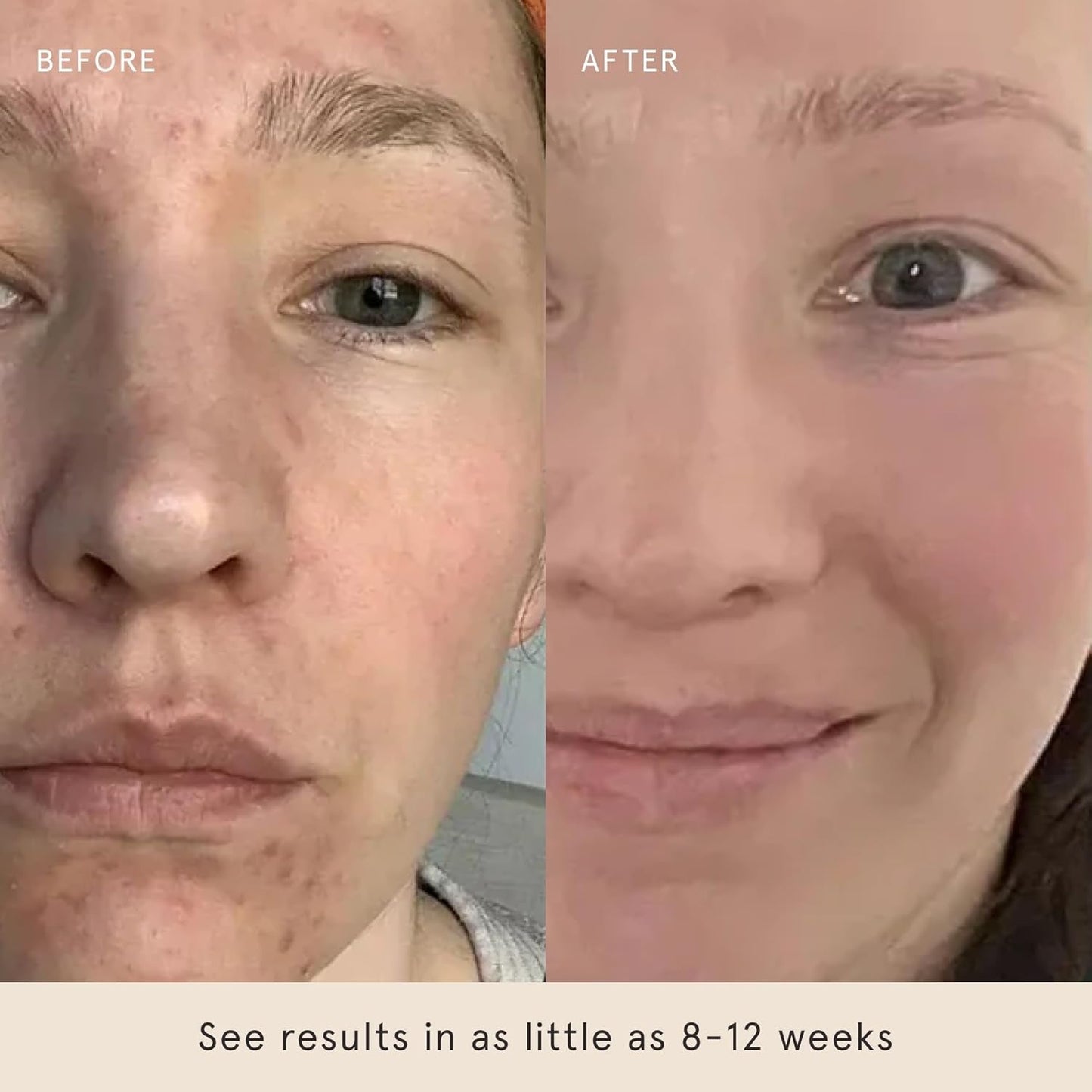 Gentle Exfoliating Face Pads 60 Count - Brighter Smoother Skin