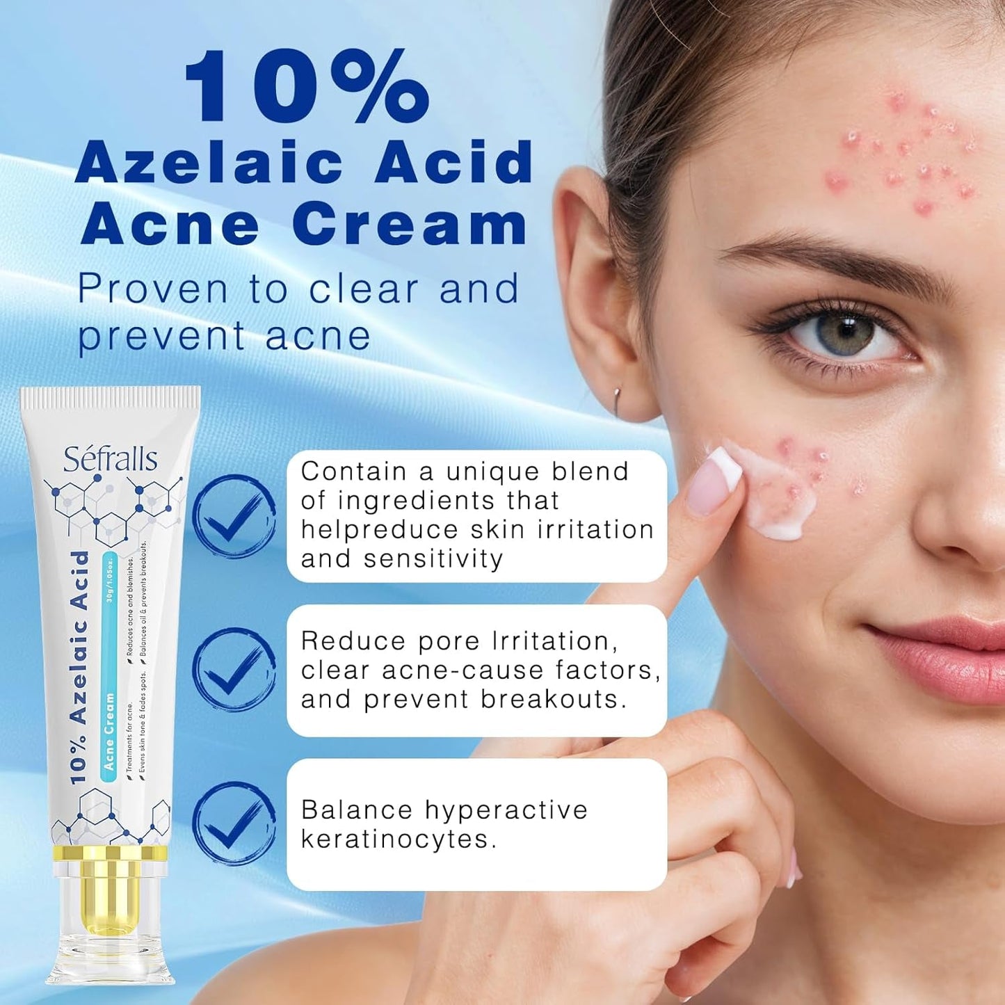 Natural Acne Treatment Cream with 10% Azelaic Acid