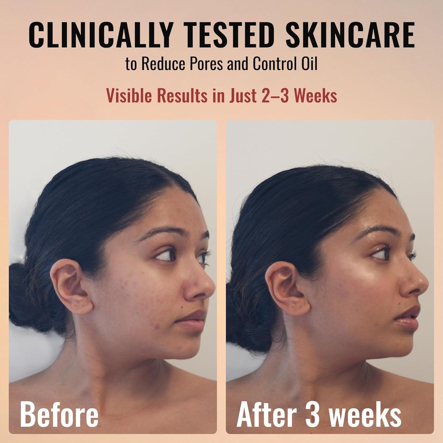 Anti-Aging Face Serum with Retinol and Niacinamide 30ml
