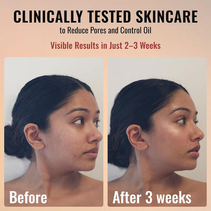 Anti-Aging Face Serum with Retinol and Niacinamide 30ml