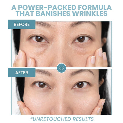Anti Aging Eye Gel - Reduces Puffiness & Dark Circles