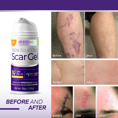 Silicone Scar Cream with SPF 30 for Sensitive Skin