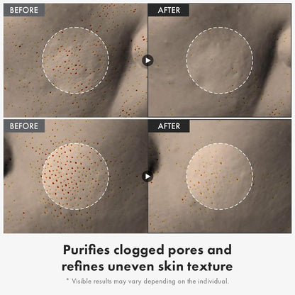 Natural Rice Face Exfoliator for Brighter Skin