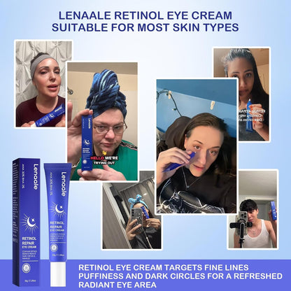 Anti Aging Eye Cream for Dark Circles & Fine Lines