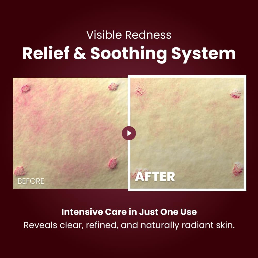 Gentle Skin Repair Moisturizer Cream