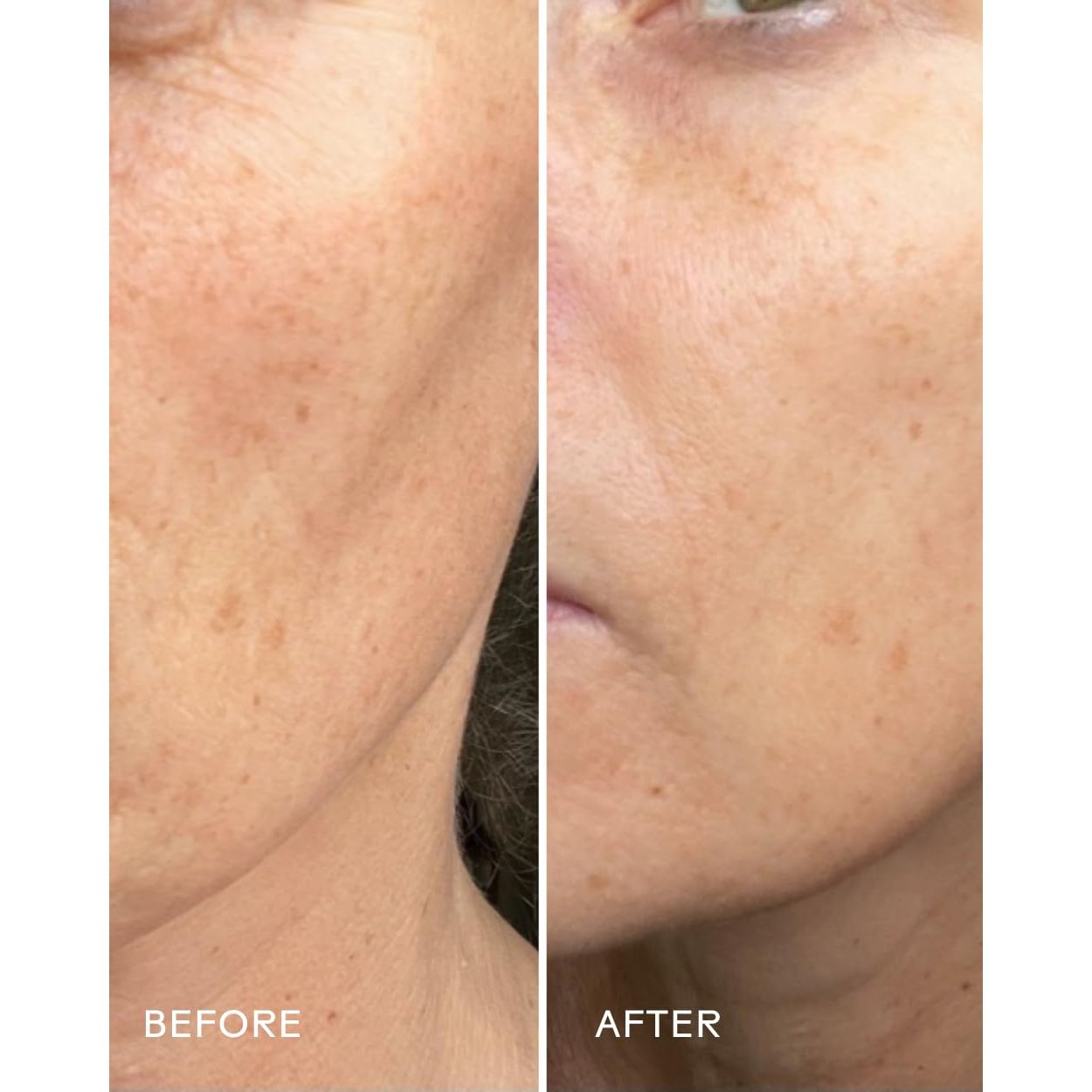 Nourishing Rosehip Oil Face Serum 30ml - Moisturizes Skin