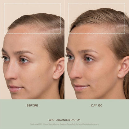 Nourishing Hair Growth Serum for Thick Full Hair