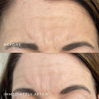 Intensive Anti-Wrinkle Face Serum 15ml