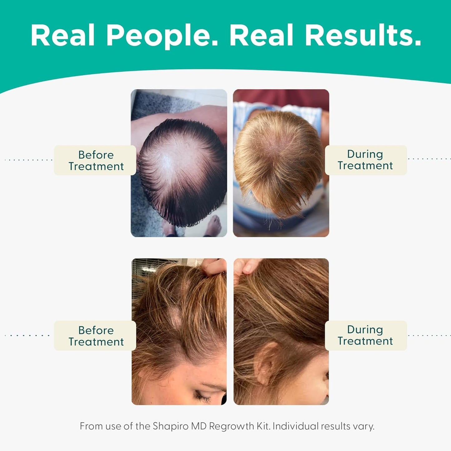 Thickening Shampoo & Conditioner Set for Stronger Hair