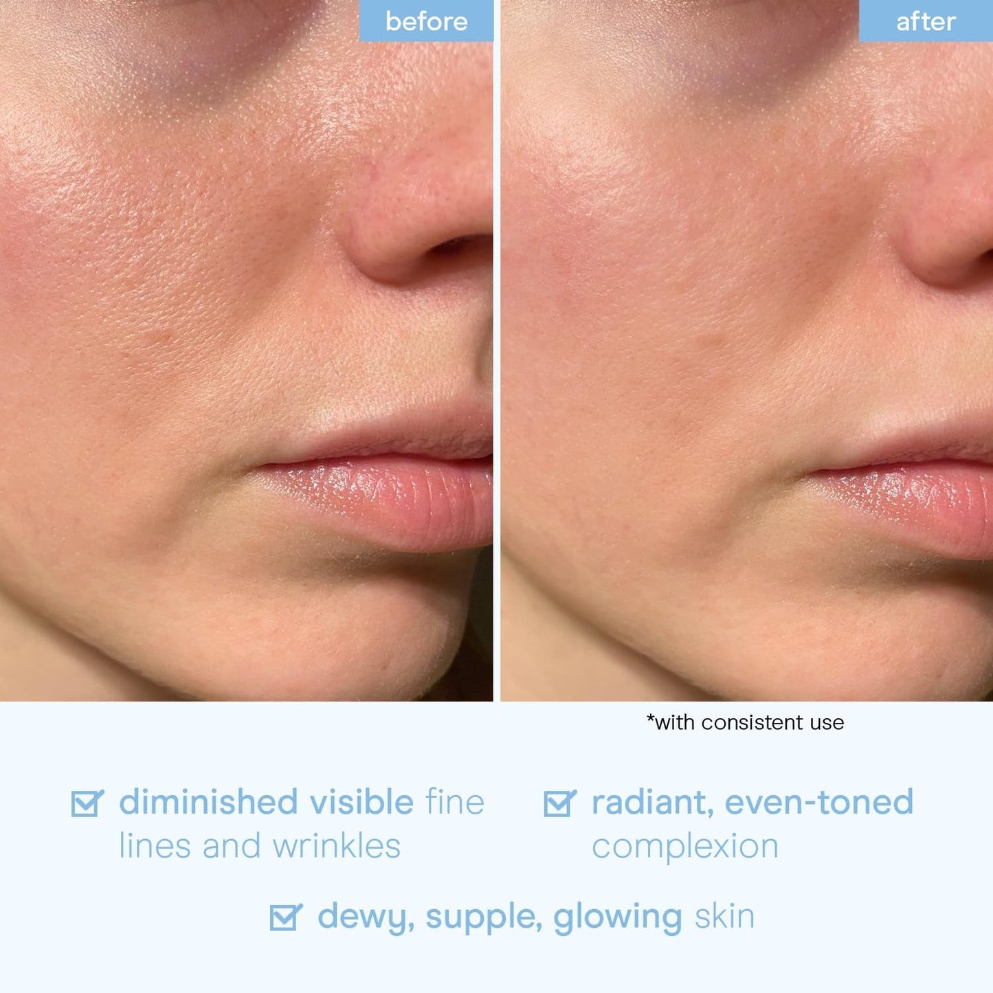 Natural Snail Serum for Glowing Skin - 100ml