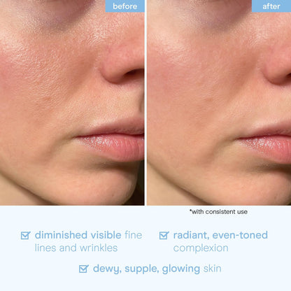 Natural Snail Serum for Glowing Skin - 100ml
