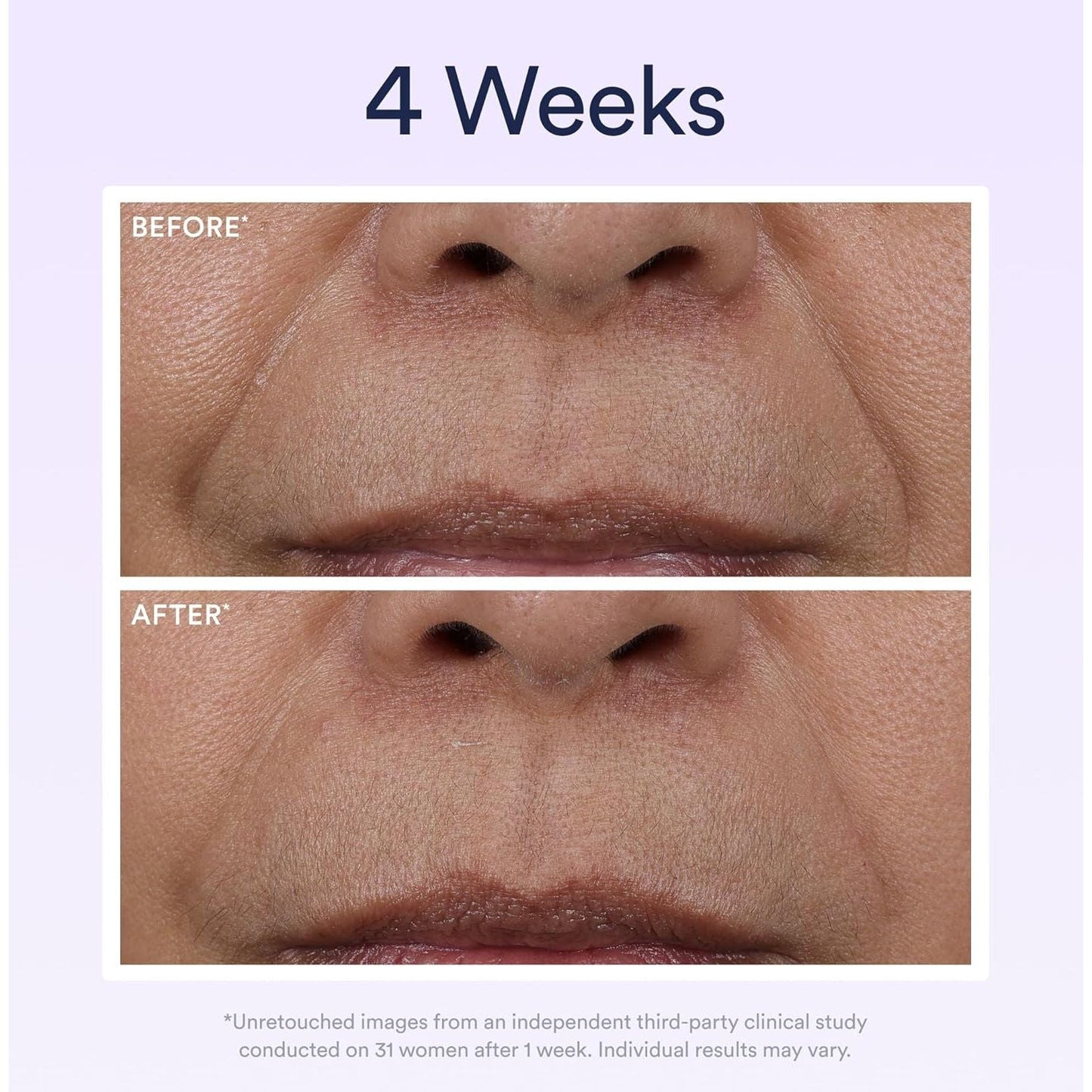Anti Aging Night Serum with Retinol for Wrinkle Repair