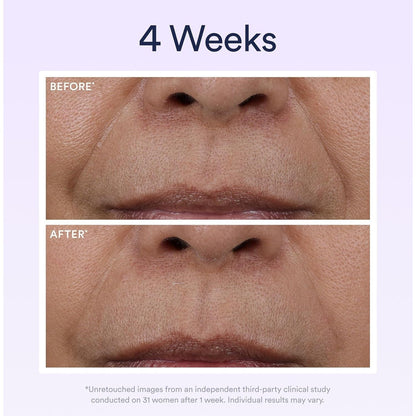 Anti Aging Night Serum with Retinol for Wrinkle Repair