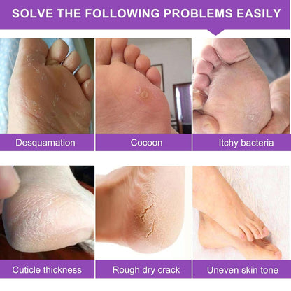 Gentle Exfoliating Foot Mask 5 Pack - Softens Rough Feet