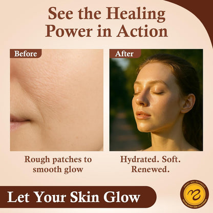 Natural Honey Skin Repair Cream