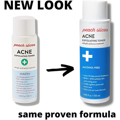 Gentle Acne Toner with Salicylic Acid for Clear Skin