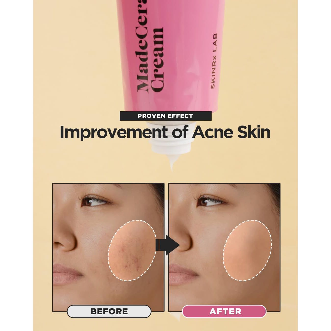 Gentle Hydrating Face Cream for Dry Sensitive Skin