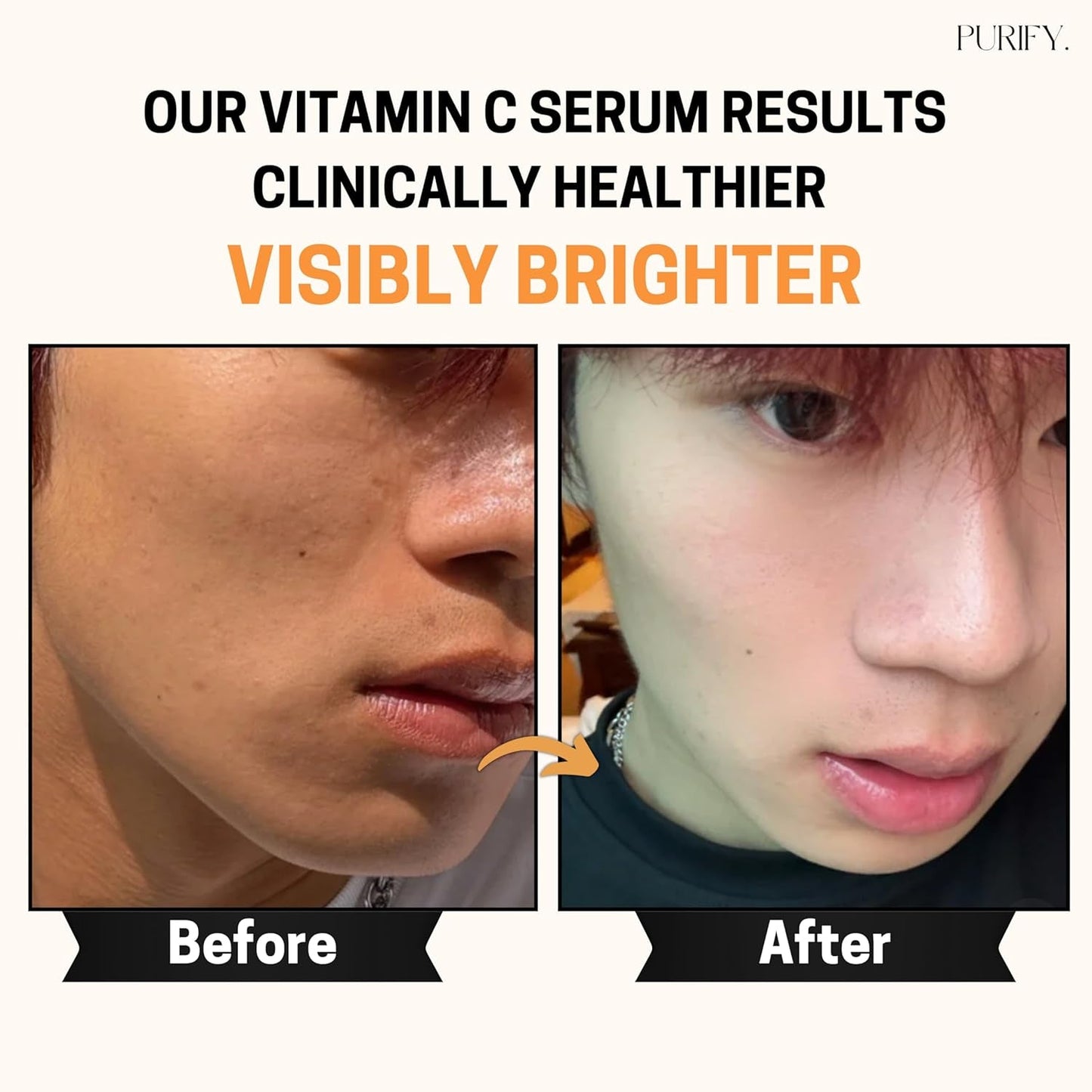 Natural Vitamin C Face Serum 30ml - Anti Aging Skin Care
