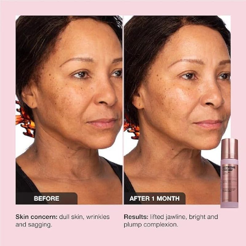 Intensive Anti Aging Face Cream Moisturizer