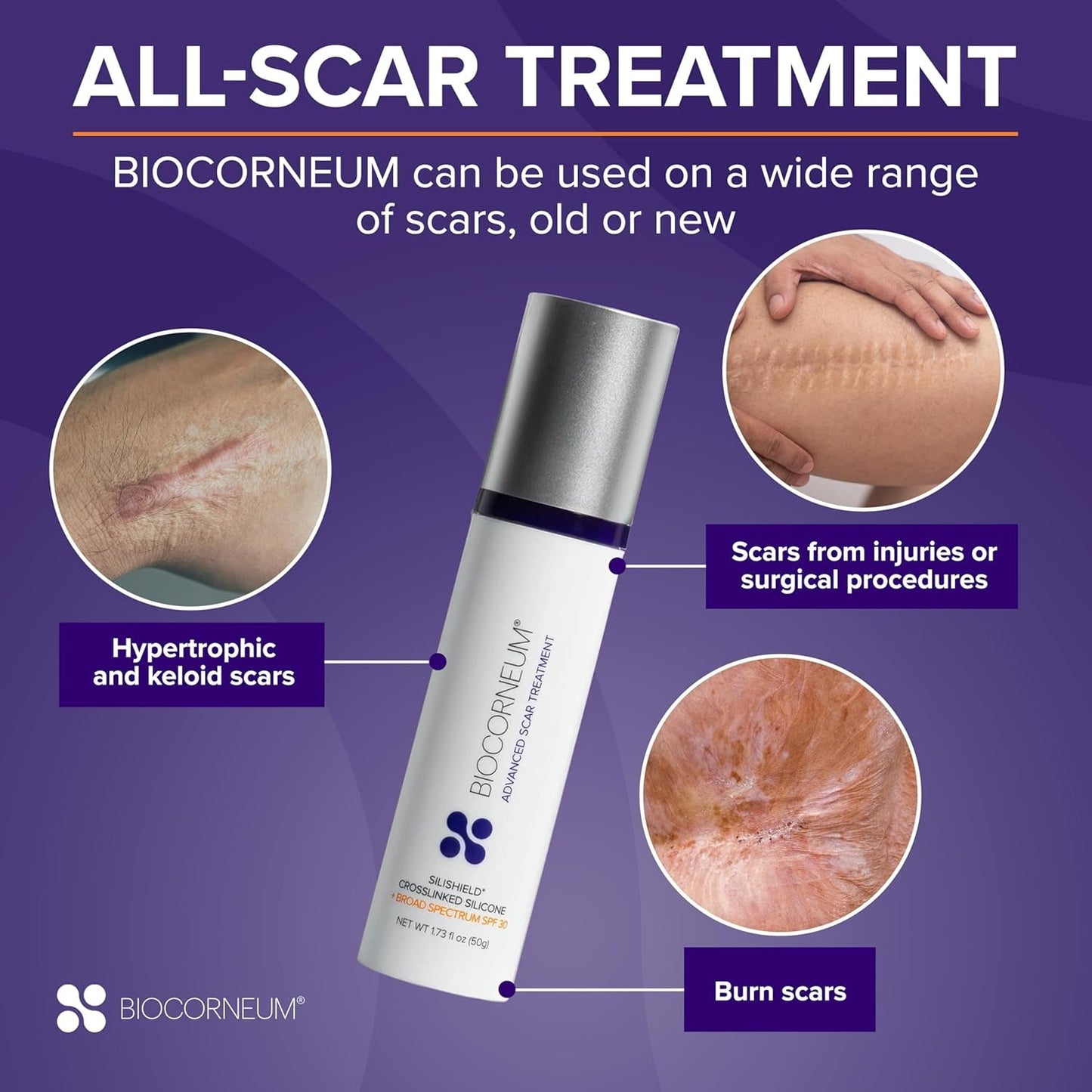 Effective Scar Removal Cream 20g