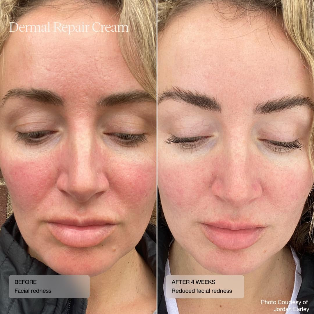 Soften & Hydrate Facial Moisturizer Cream