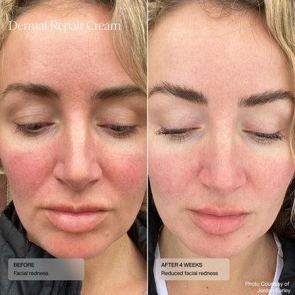 Soften & Hydrate Facial Moisturizer Cream