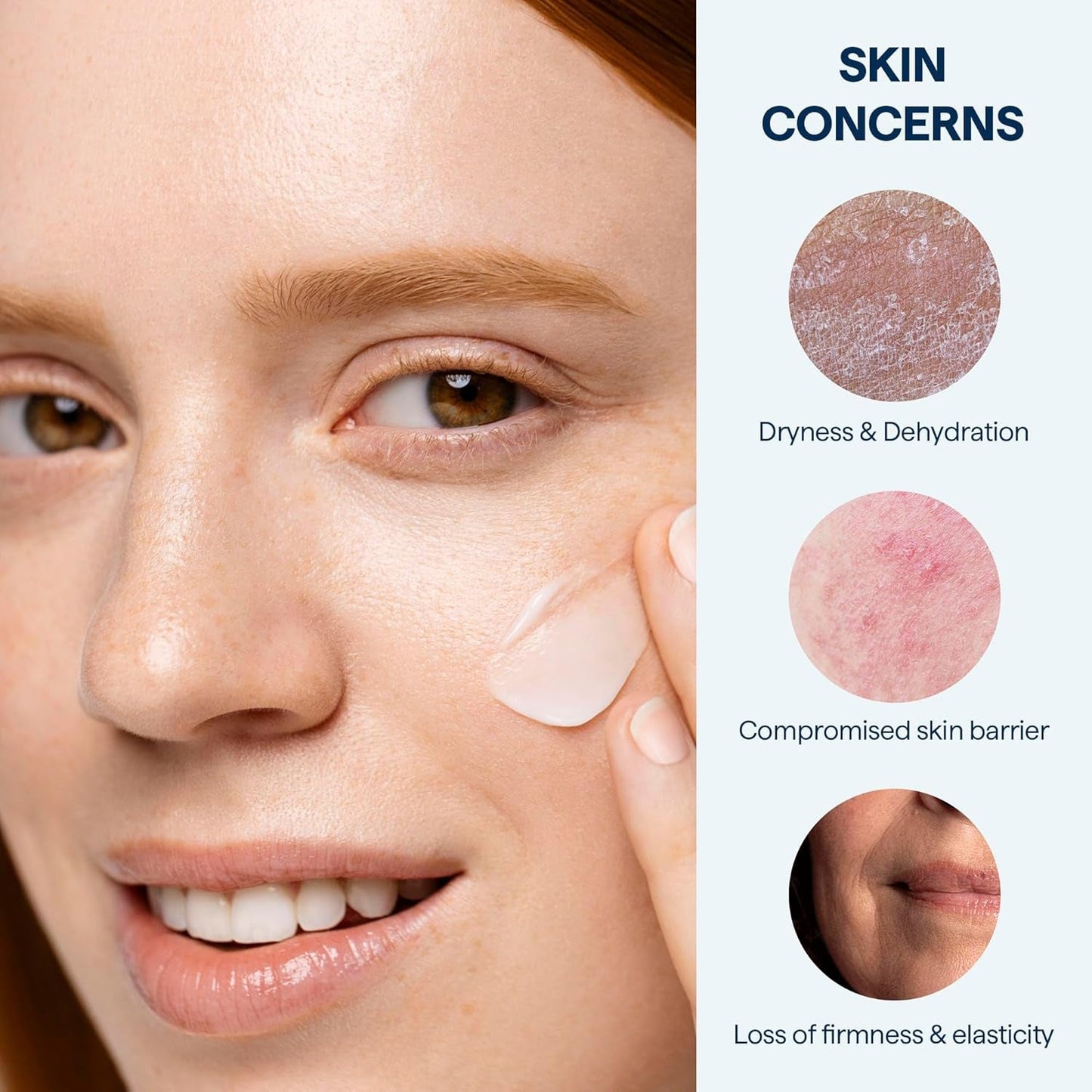 Intensive Hydrating Cream Moisturizer for Dry Skin