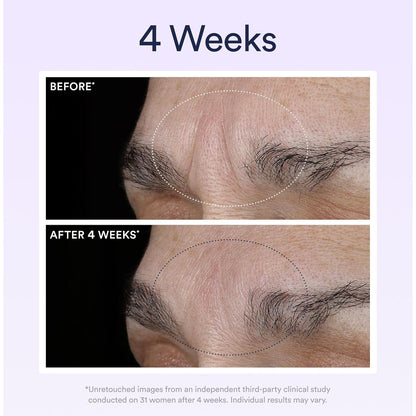 Anti Aging Night Serum with Retinol for Wrinkle Repair