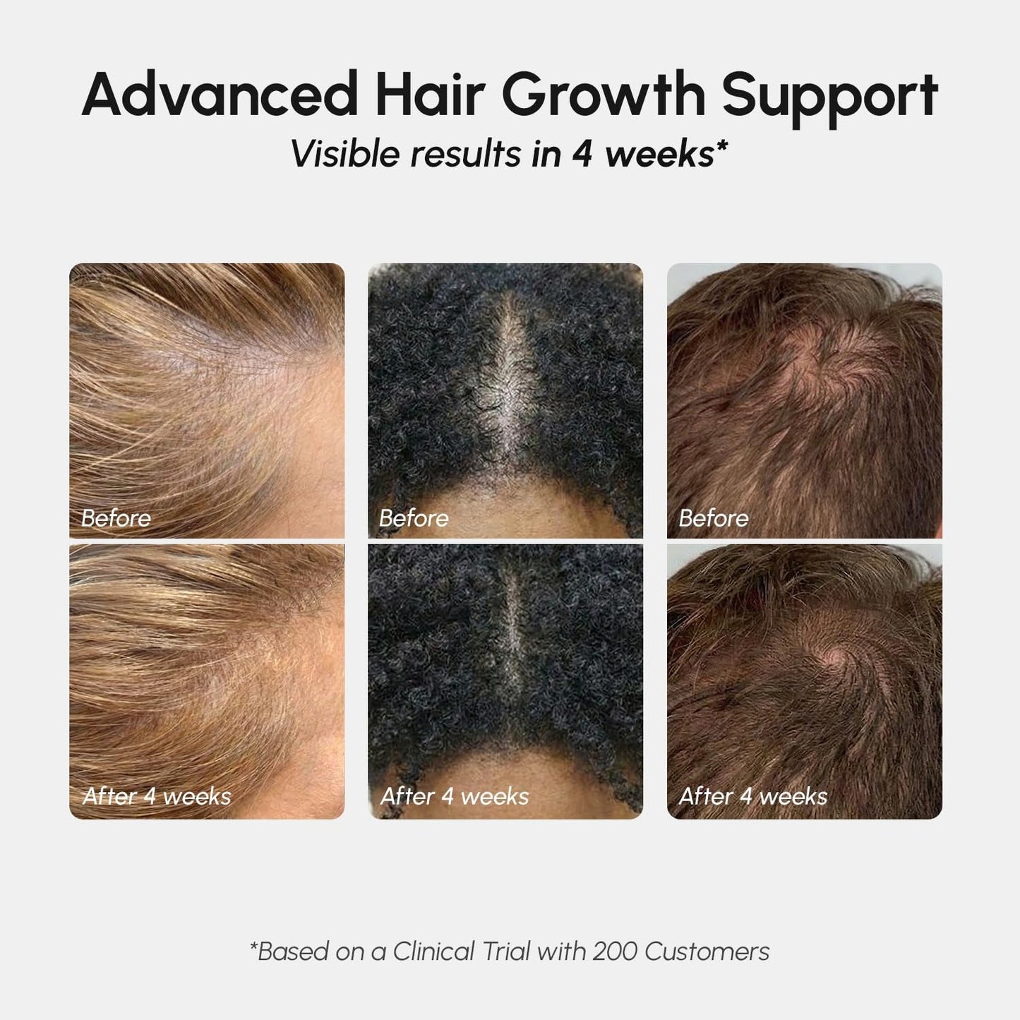 Natural Hair Regrowth Spray for Thinning Hair