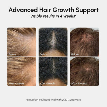 Natural Hair Regrowth Spray for Thinning Hair