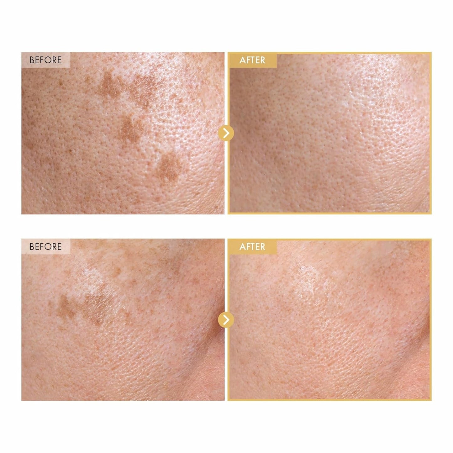 Intensive Hydrating Snail Serum 30ml Brightening Glow Treatment