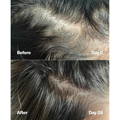 Nourishing Hair Growth Serum for Thicker Hair - 60ml